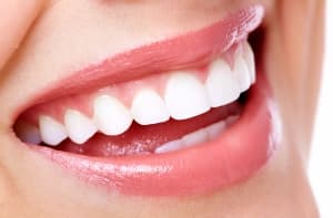 Diseño de Sonrisa en Cúcuta